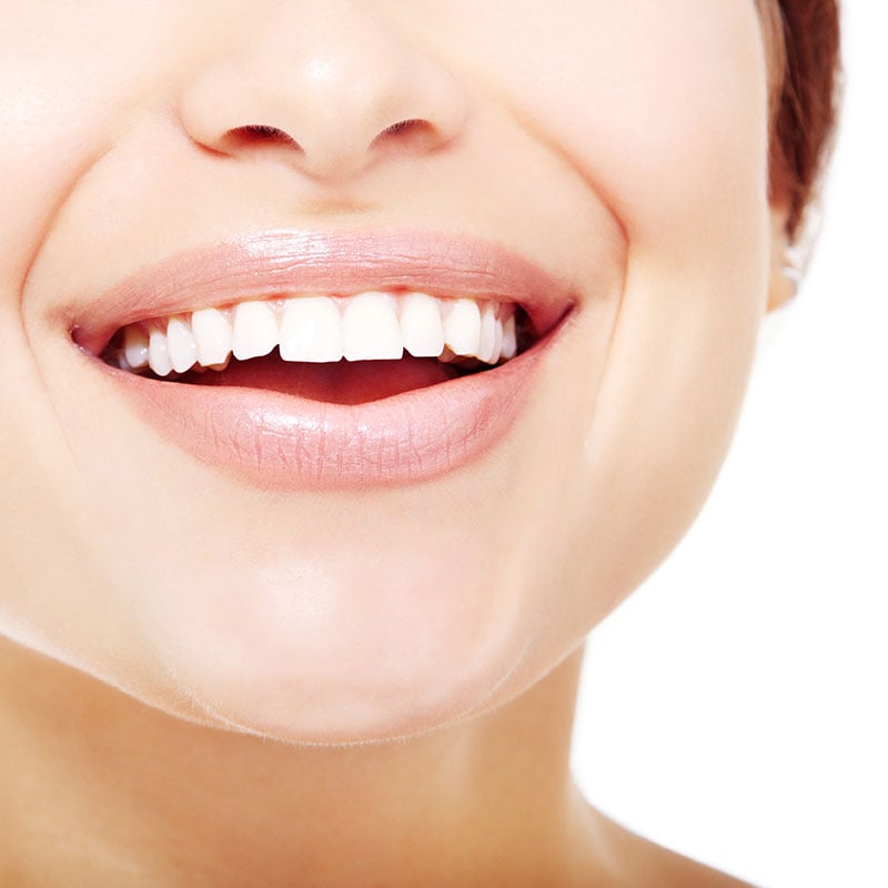 Quelles sont les principales techniques de traitement orthodontique ?